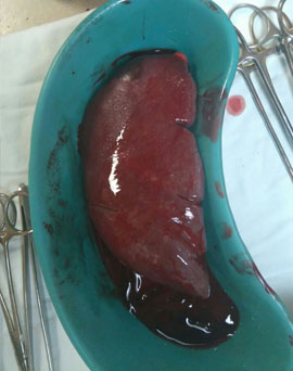 Picture 1