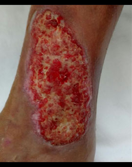 Picture 1